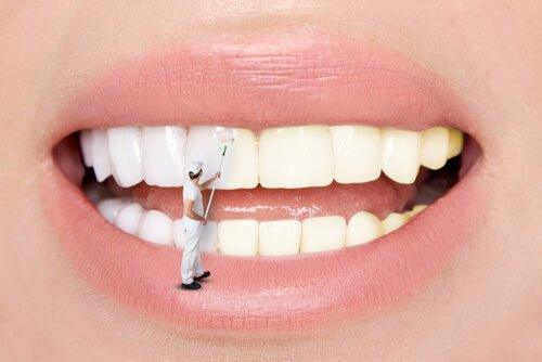 after care teeth whitening treatment