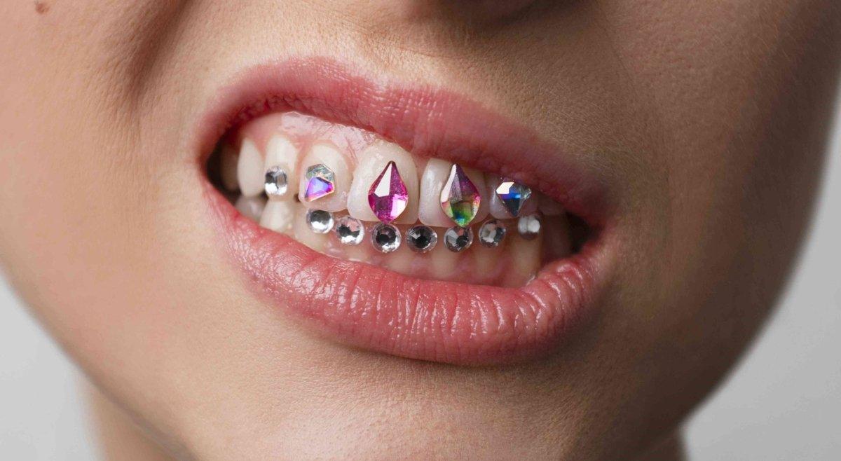 tooth gems