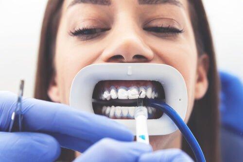 teeth whitening supplies